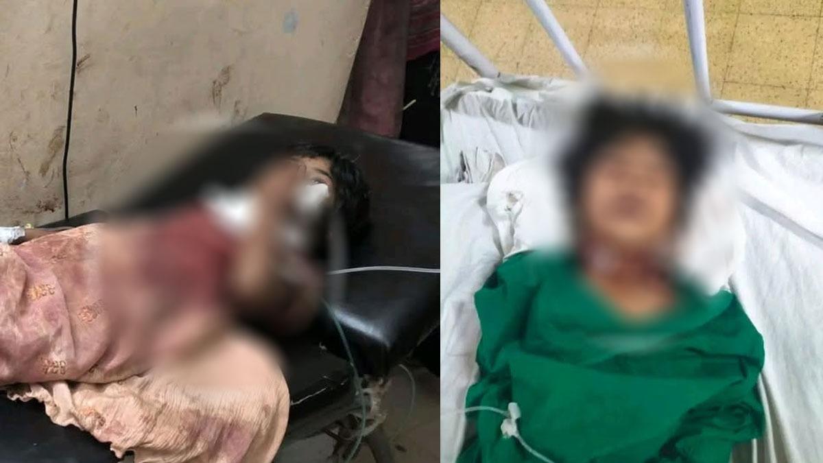 রক্তাক্ত গলা নিয়ে হাঁটছিল শিশুটি, অপহরণ-হত্যাচেষ্টায় মামলা