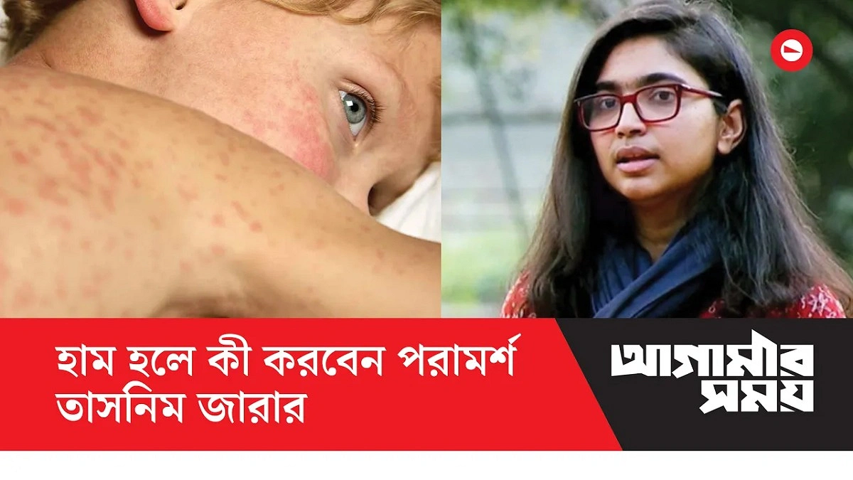 হামের প্রকোপ কতটুকু? স্পষ্ট তথ্য দিচ্ছে না সরকার: তাসনিম জারা