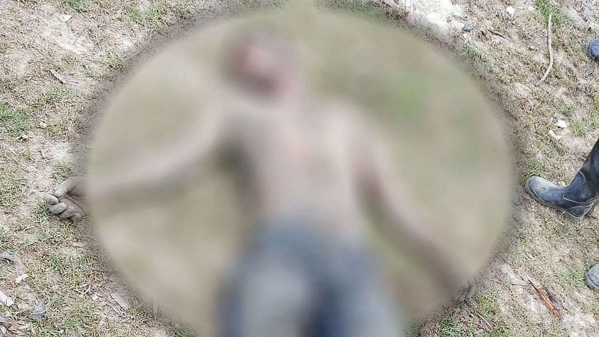 মাইন বিস্ফোরণে পা হারালেন রোহিঙ্গা যুবক