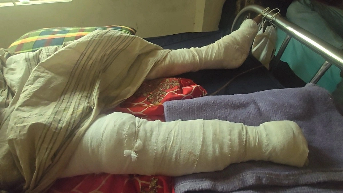 মামলার সাক্ষ্য দেওয়ায় যুবকের হাত-পা বিচ্ছিন্নের অভিযোগ