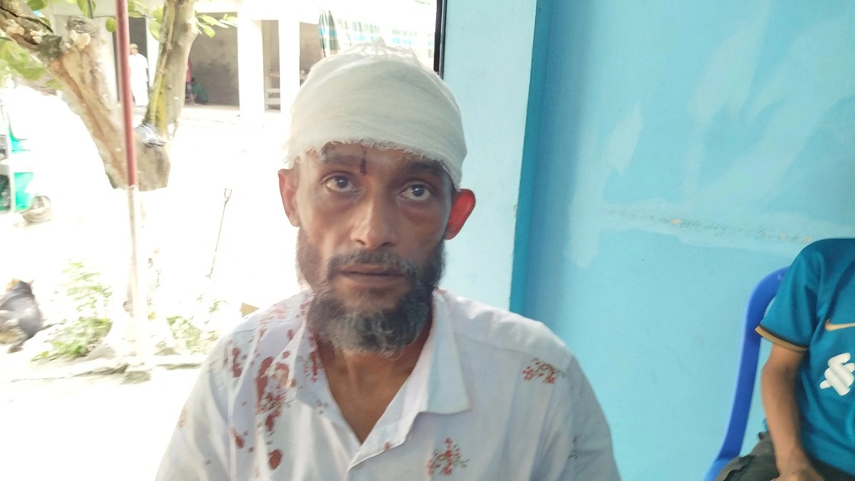জিডি করায় চাচাকে রডের আঘাতে জখমের অভিযোগ