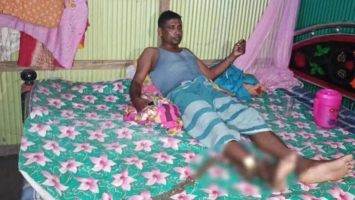পাওনা টাকা আদায়ে অটোচালককে শিকলে বেঁধে নির্যাতনের অভিযোগ