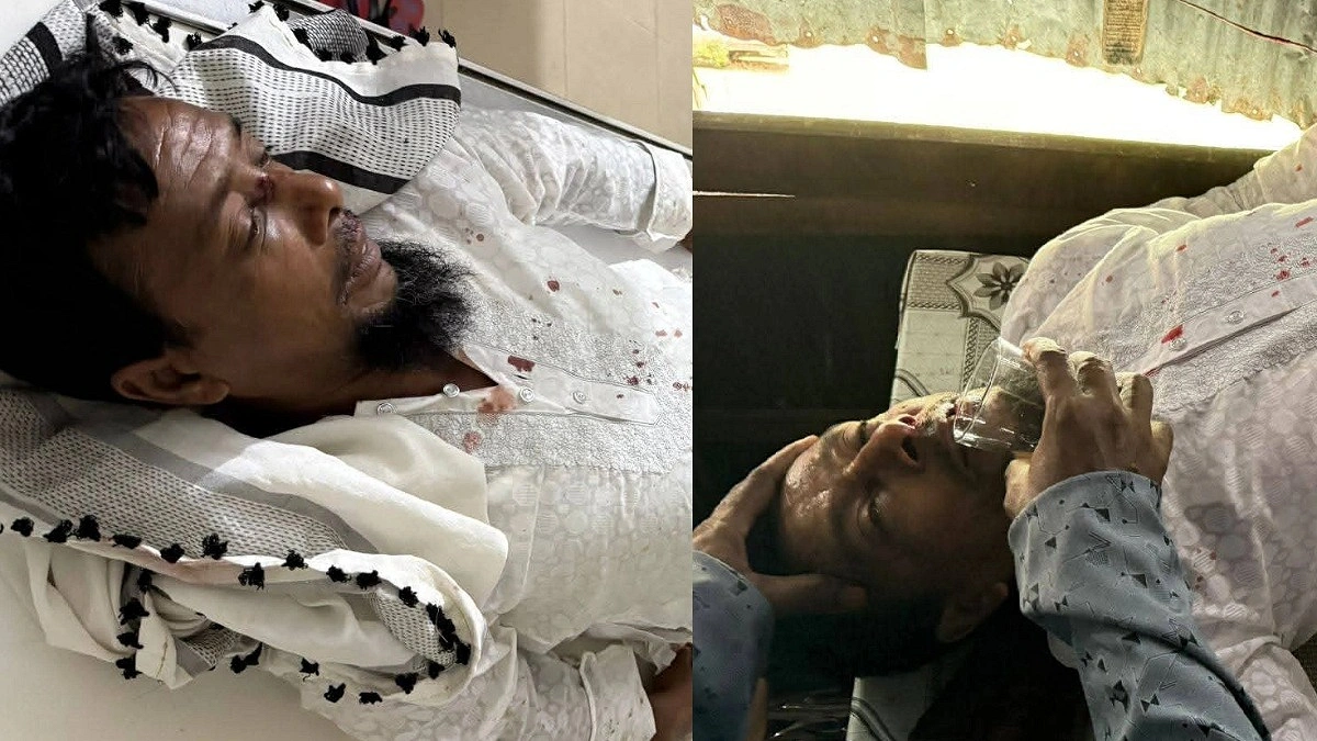 সমাবেশে যাওয়ার পথে জামায়াত নেতাকর্মীদের ওপর হামলা, আহত ৬
