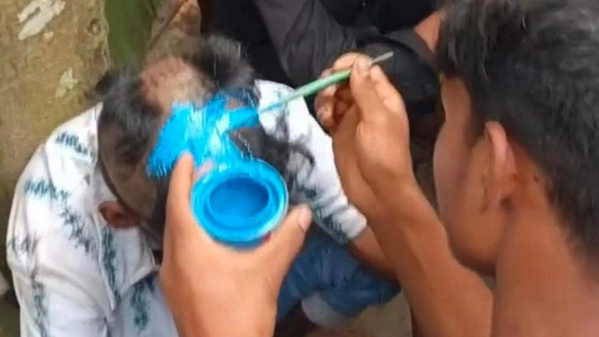 ‘চুরি করায়’ ন্যাড়া মাথায় আঁকা হলো আর্জেন্টিনার পতাকা