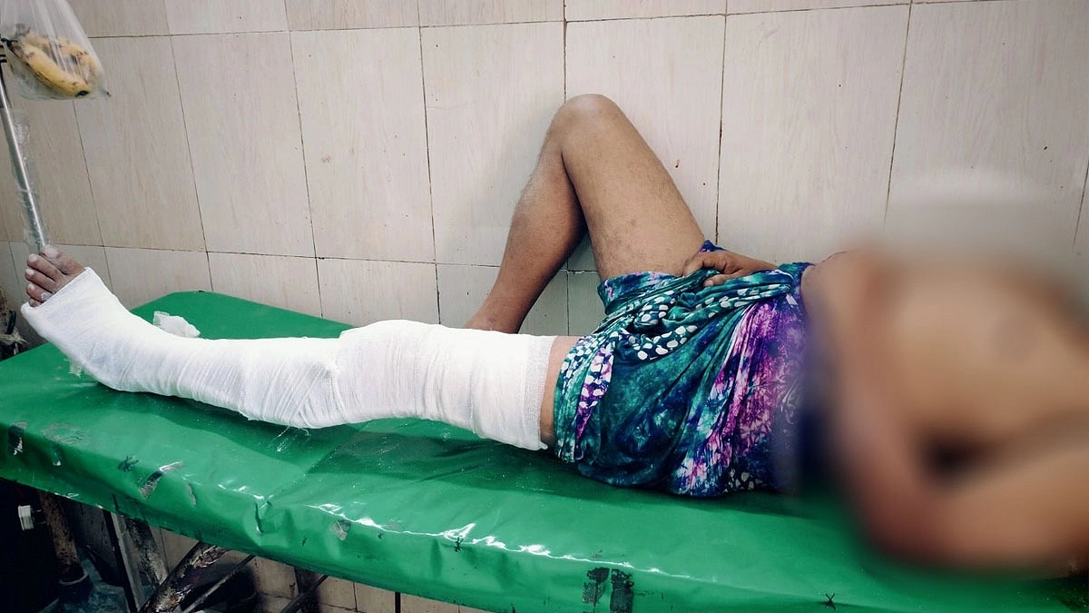চাঁদা না পেয়ে ব্যবসায়ীর হাত-পা ভেঙে দিলেন শ্রমিকদল নেতা