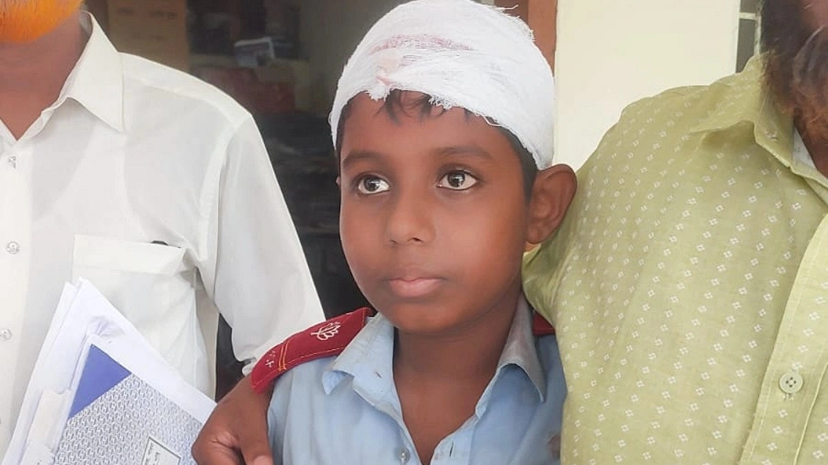 শ্রেণিকক্ষে মাথায় ফ্যান পড়ে শিক্ষার্থী আহত