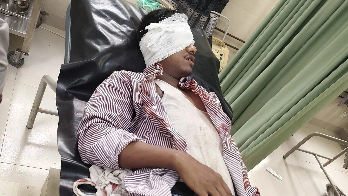 সিরাজগঞ্জে চলন্ত ট্রেনে পাথর নিক্ষেপ, যাত্রীর চোখে গুরুতর আঘাত