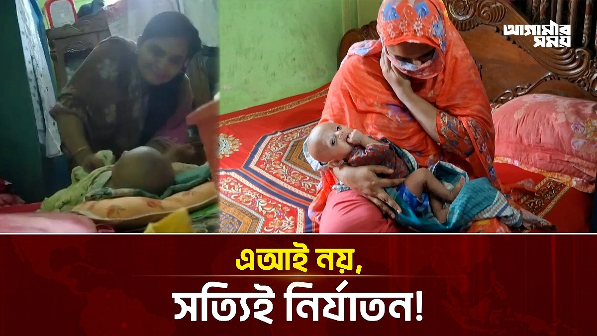 এআই নয়, সত্যিই মচকে দেয়া হয়েছিল দুই মাসের শিশুর পা