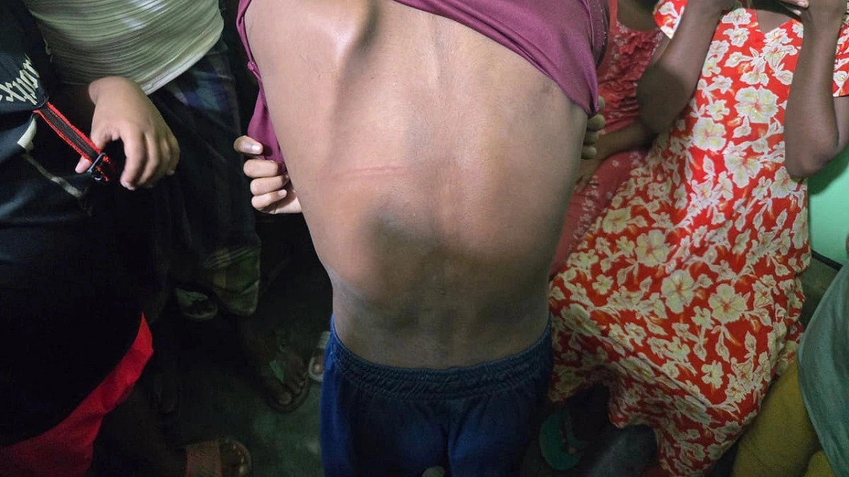 বিদ্যুতের তার দিয়ে শিক্ষার্থীদের পেটালেন স্কুলশিক্ষক