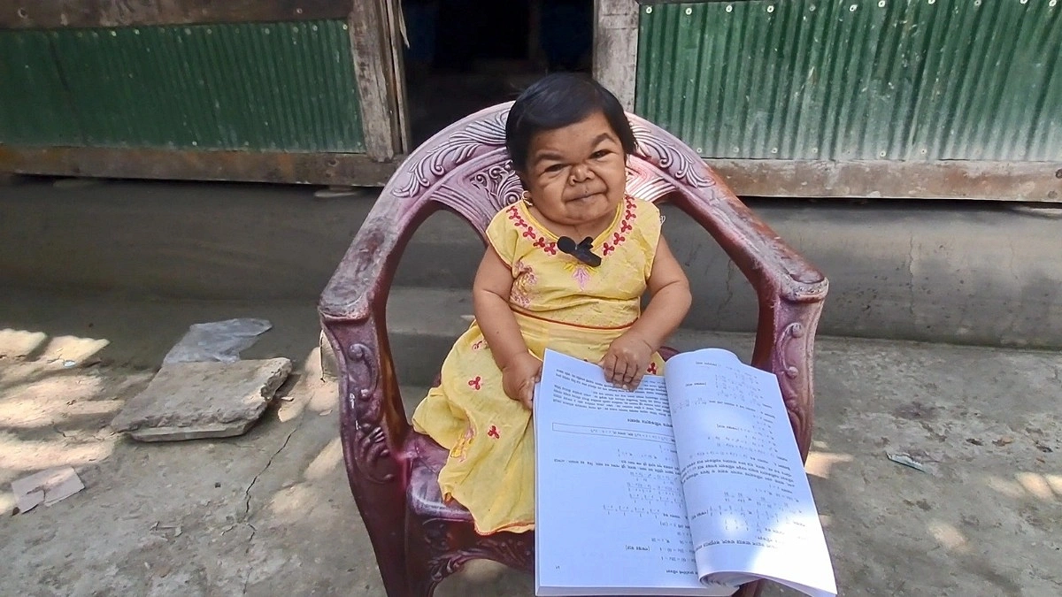 ৩৫ বছর বয়স, উচ্চতা মাত্র ২৮ ইঞ্চি—শৈশবেই থেমে আছে মিলির জীবন