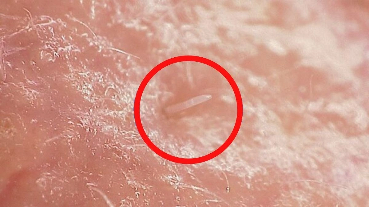 মানুষ একা নয়, সব সময় সঙ্গে থাকে যে আজব প্রাণী!