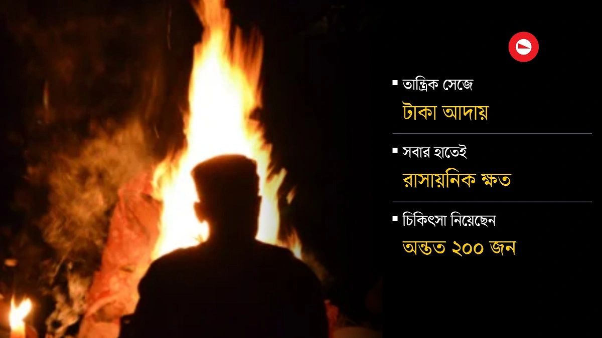 জিনের ভয় দেখিয়ে ক্ষতবিক্ষত হাত, অতঃপর ...