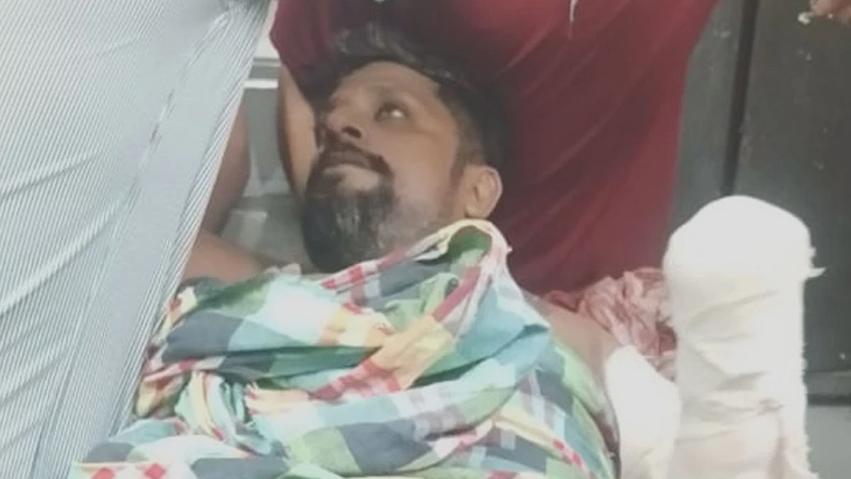যুবদল নেতাকে কুপিয়ে জখম কবজি বিচ্ছিন্ন