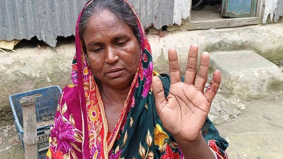 কুকুরের ভয়ে ঘরবন্দি, সন্তানদের স্কুলে পাঠাতেও শঙ্কা