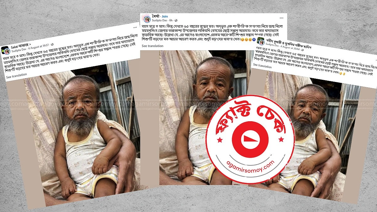 ময়মনসিংহে বিরল শিশুর জন্ম নেওয়ার খবরটি কি সত্যি
