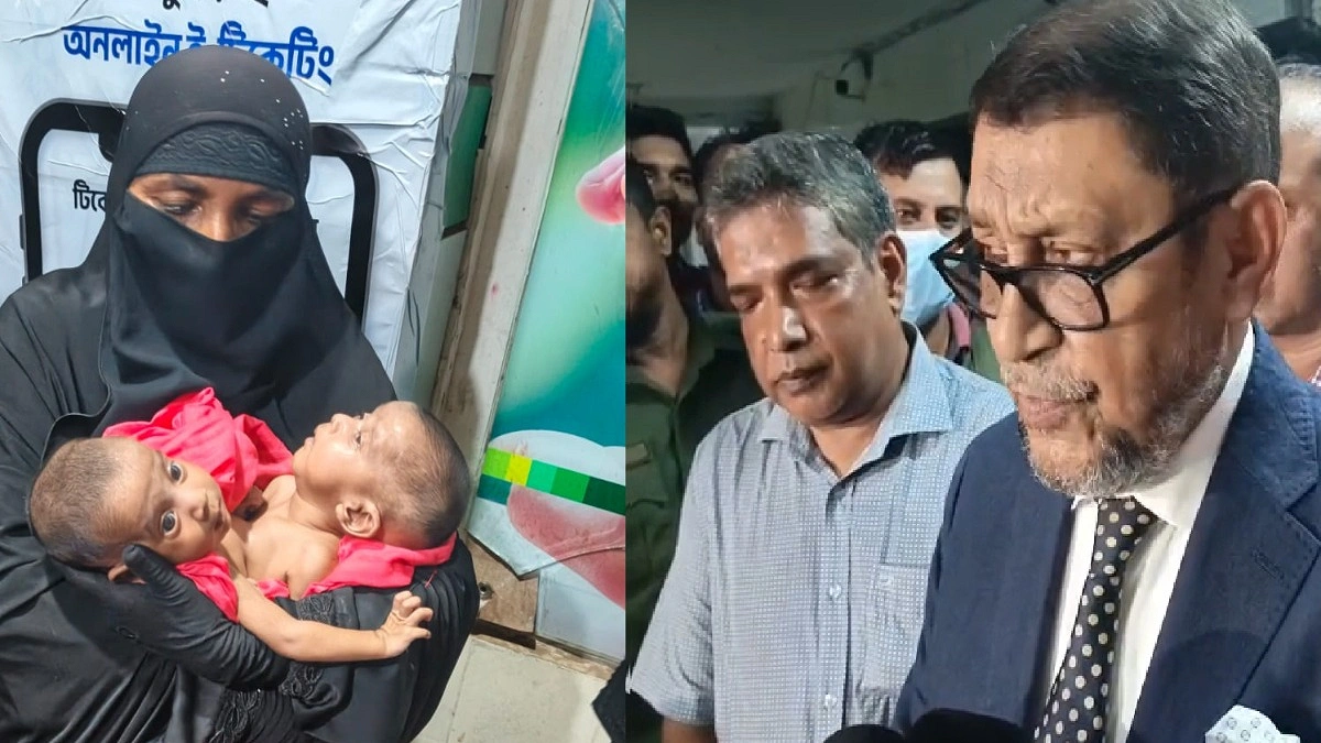 জোড়া লাগা যমজ শিশুর চিকিৎসা হবে সরকারি খরচে: স্বাস্থ্যমন্ত্রী