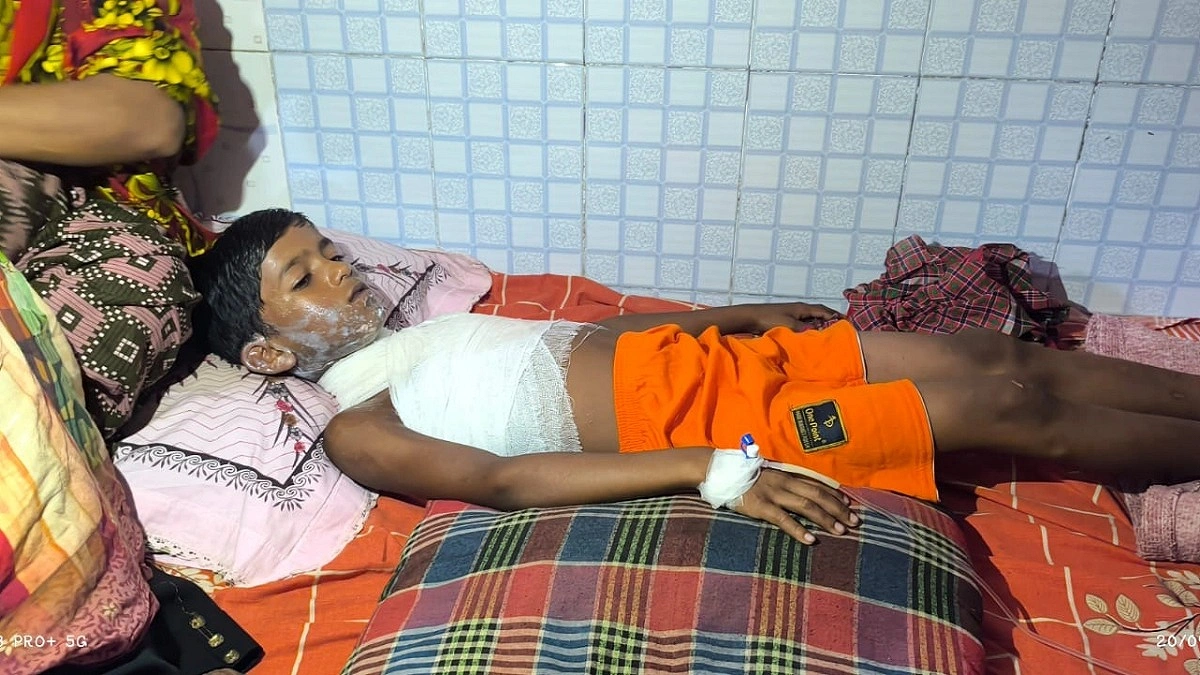 মিড ডে মিলের ডিম সিদ্ধ করার গরম পানিতে পড়ে শিক্ষার্থী দগ্ধ