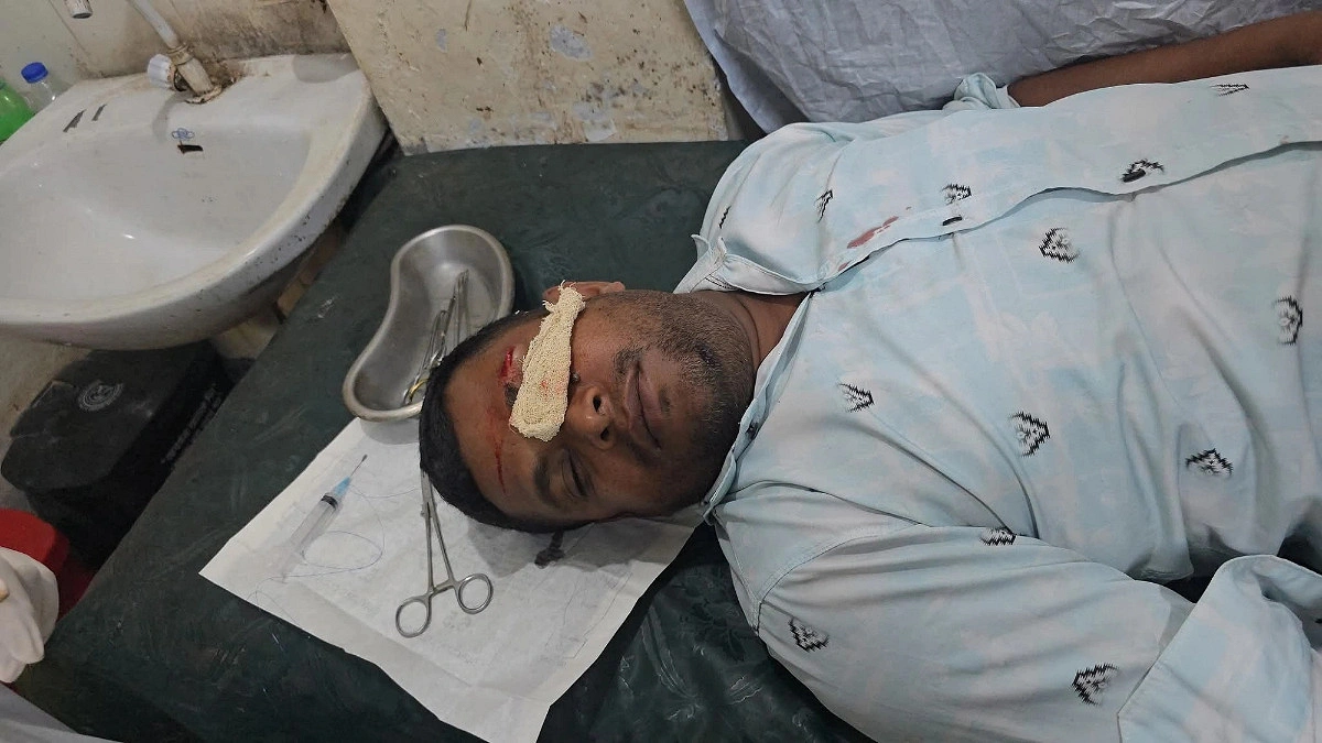 সংবাদ প্রকাশের জেরে সাংবাদিকের ওপর হামলা, জখম
