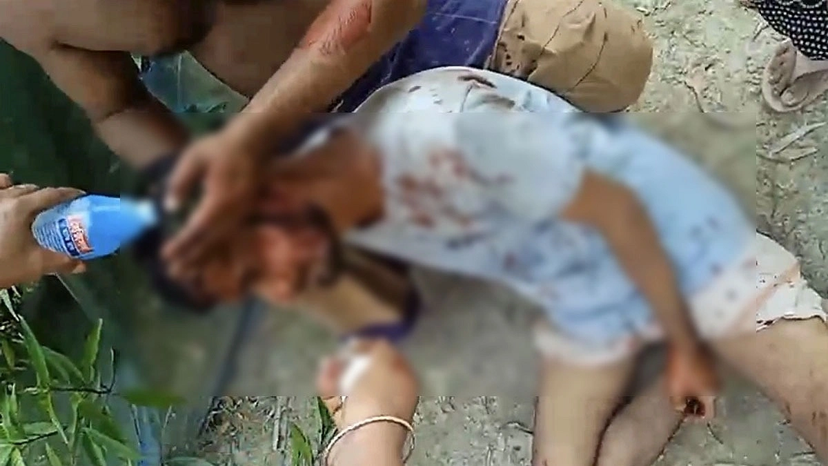 বাউফলে জমিতে সার দিতে গিয়ে দুই ভাইকে কুপিয়ে জখম