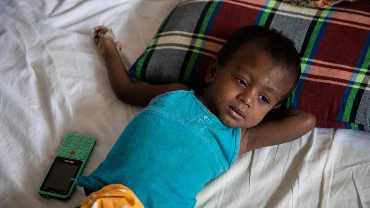 Measles, related symptoms claim 17 more lives