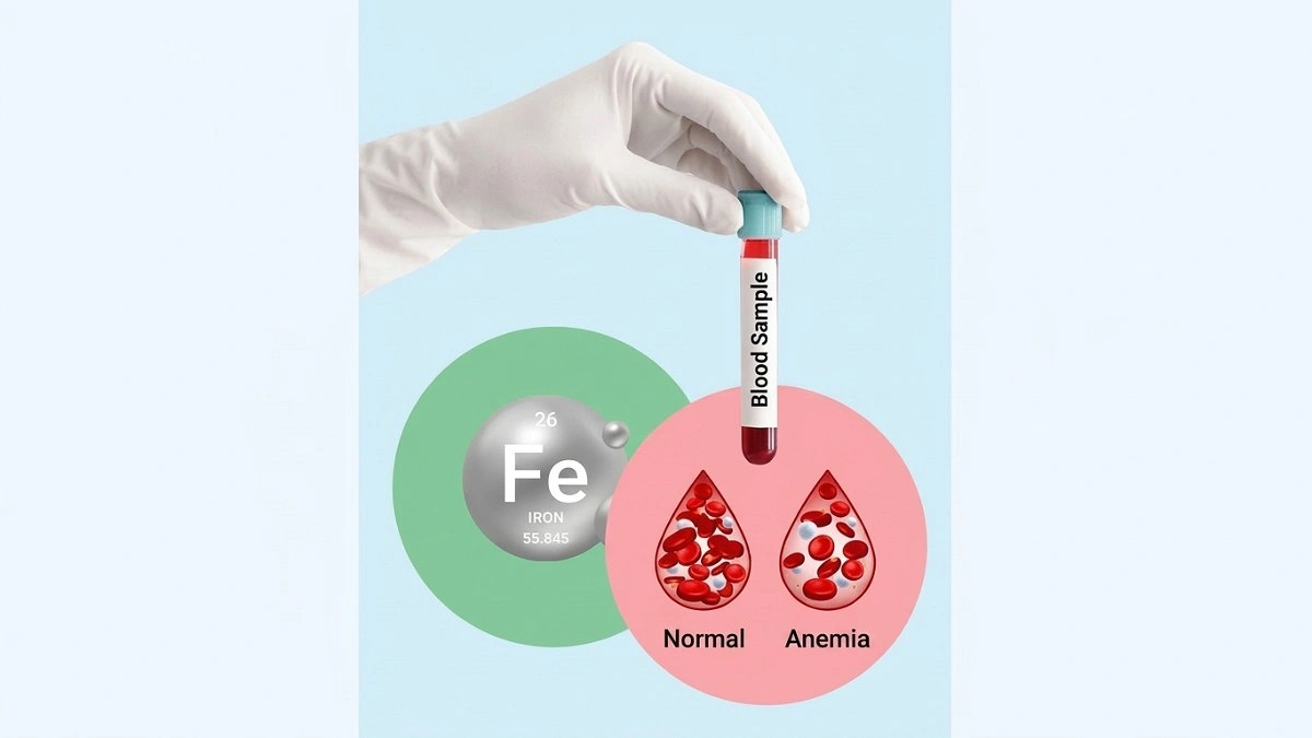 Anemia: Iron deficiency is not the only culprit