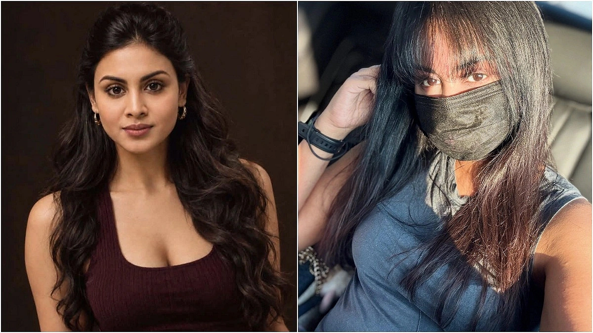 Actress frustrated about any booking after facial Injuries in accident